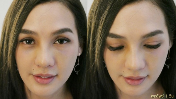 การทำศัลยกรรมตาสองชั้น