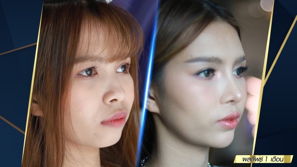 เสริมจมูก