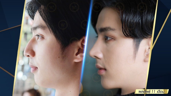 เสริมจมูก