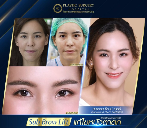 หนังตา/หางตาบนตก