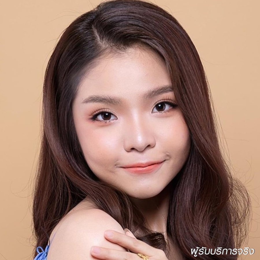 شد الجفن العلوي