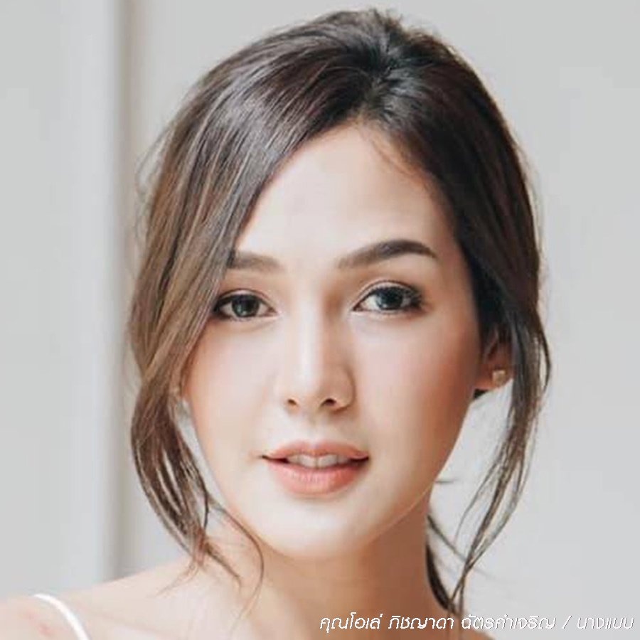 شد الجفن العلوي