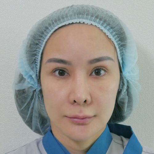 脸部和颈部的提升和抽脂