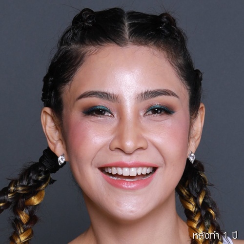 脸部和颈部的提升和抽脂